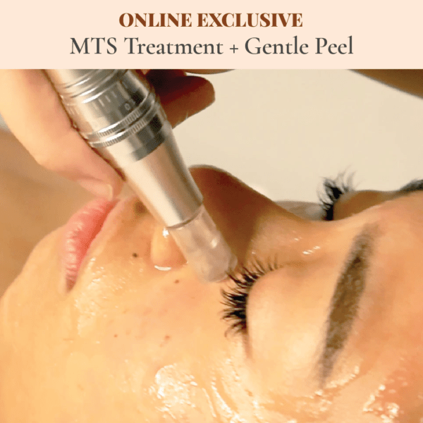 MTS Treatment + Gentle Peel Treatment x3 Package