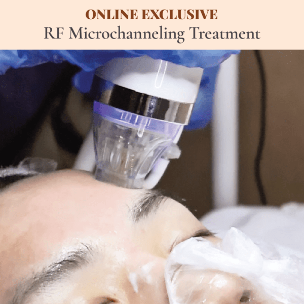 RF Microchanneling Treatment x3 Package